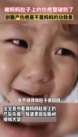 全球知名疤痕修复品牌“芭克”:38女神节 为剖腹产妈妈发声