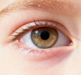 近视眼为什么要“少吃甜食”？近视和甜食之间有什么关系？